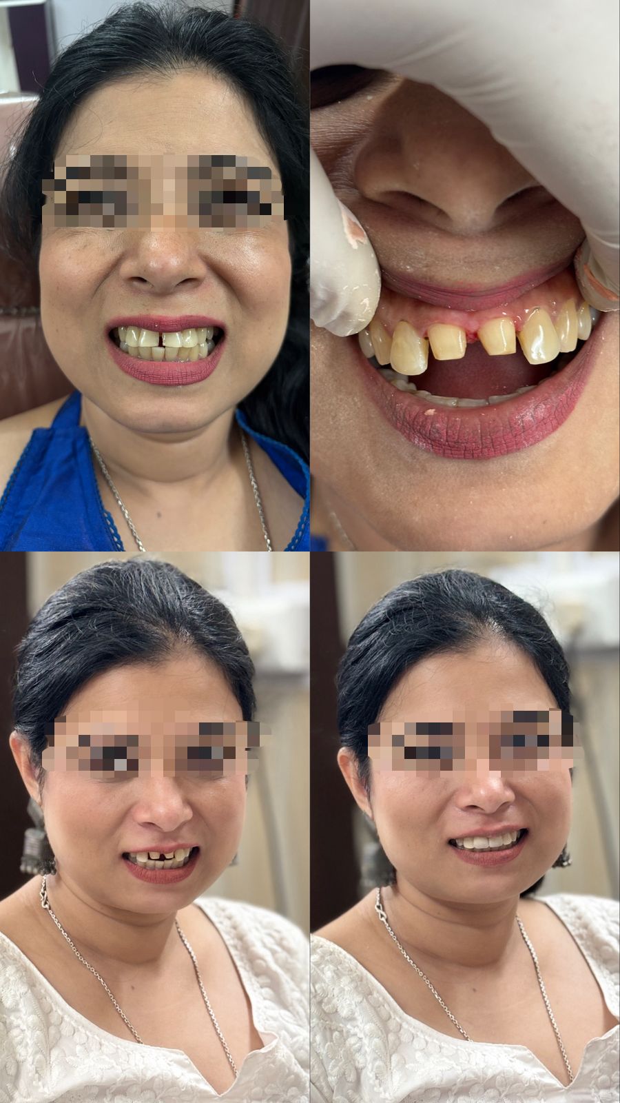 Before and after: Smile Makeover